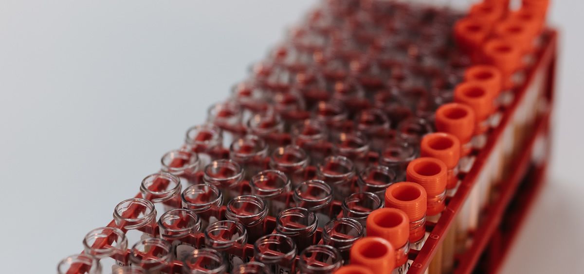 muestras de laboratorio