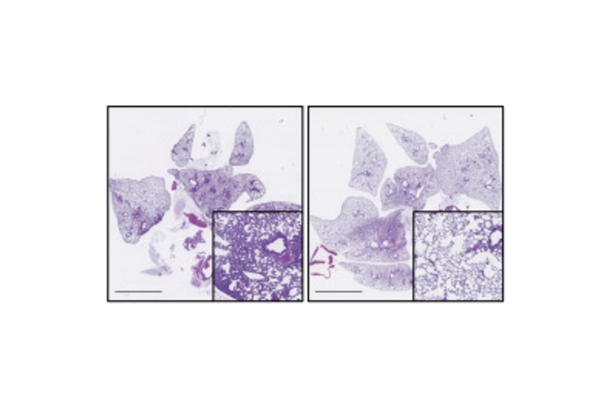 nueva molecula valor 35287 11132334