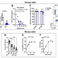 Key to new lupus treatment could depend on protein in the blood