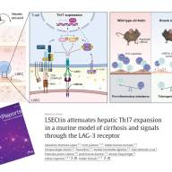 Investigadores identifican un mecanismo inmunológico clave que podría reducir la inflamación crónica en la cirrosis hepática