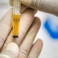Biomarker in urine could be the first to reveal early-stage Alzheimer's disease