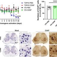 A promising drug candidate for ALS prolongs lifespan and eases symptoms in rats and mice