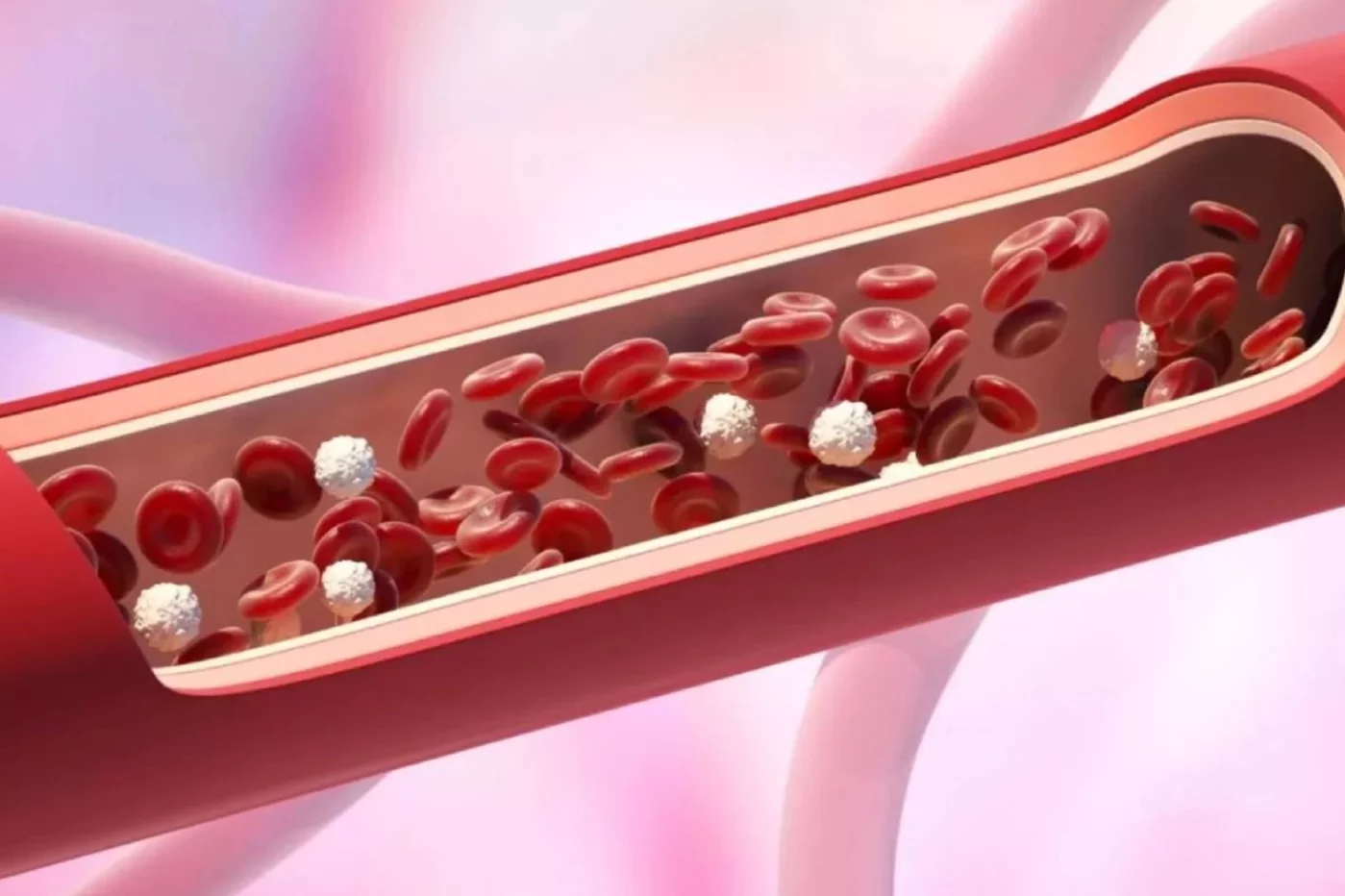 Nuevo biomarcador para detectar precozmente placa arteriosclerótica en diabetes tipo 1
